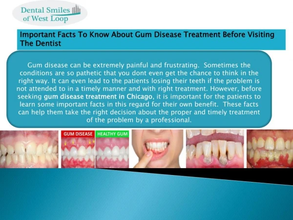 Important Facts To Know About Gum Disease Treatment Before Visiting The Dentist