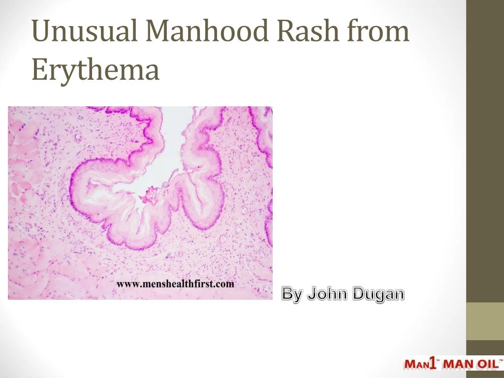 unusual manhood rash from erythema