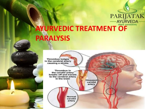 Best Ayurvedic Treatment Paralysis India |Ayurveda for Paralysis Kerala