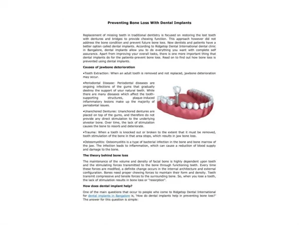 Preventing Bone Loss With Dental Implants