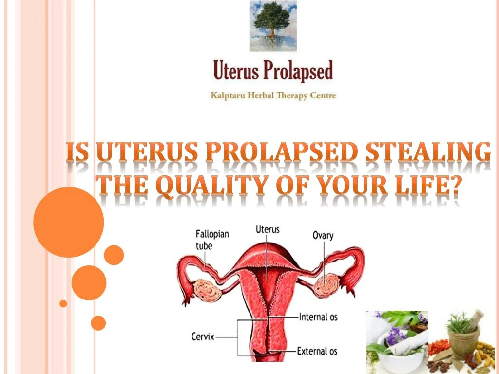 is uterus prolapsed stealing the quality of your