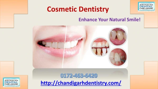 Affordable cosmetic dentistry in chadigarh