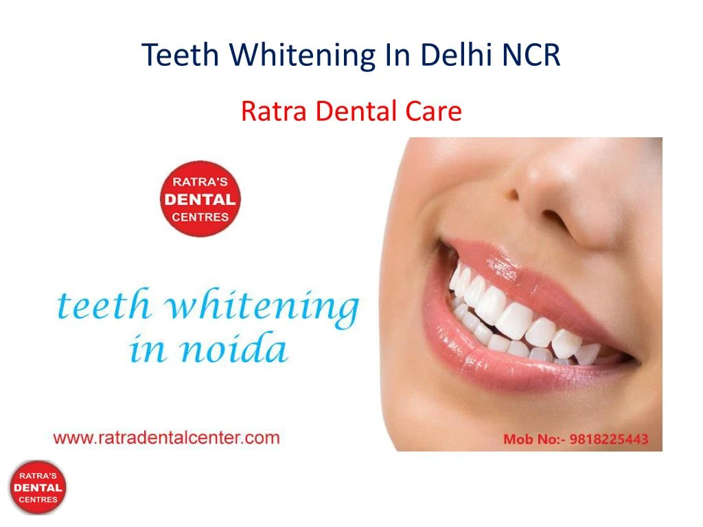 teeth whitening in delhi ncr