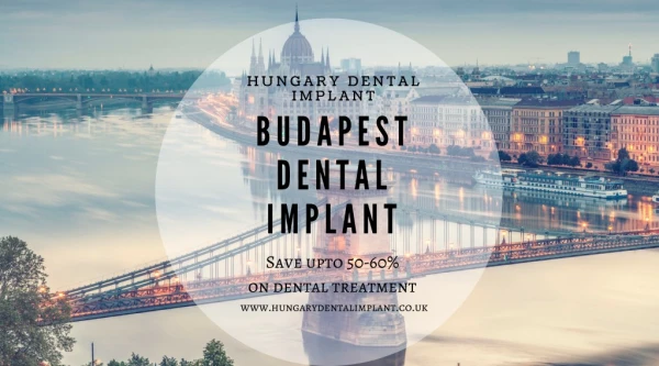 Dental Implant in Budapest