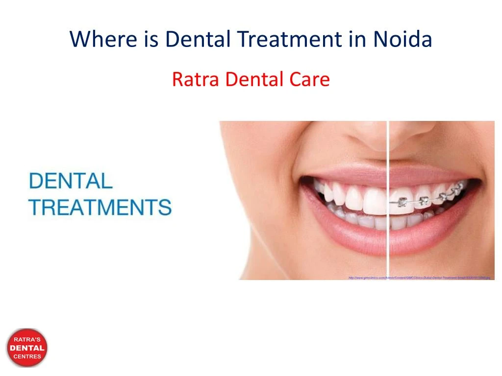 where is dental treatment in noida