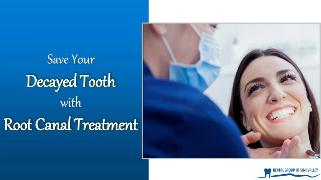 save your decayed tooth with root canal treatment