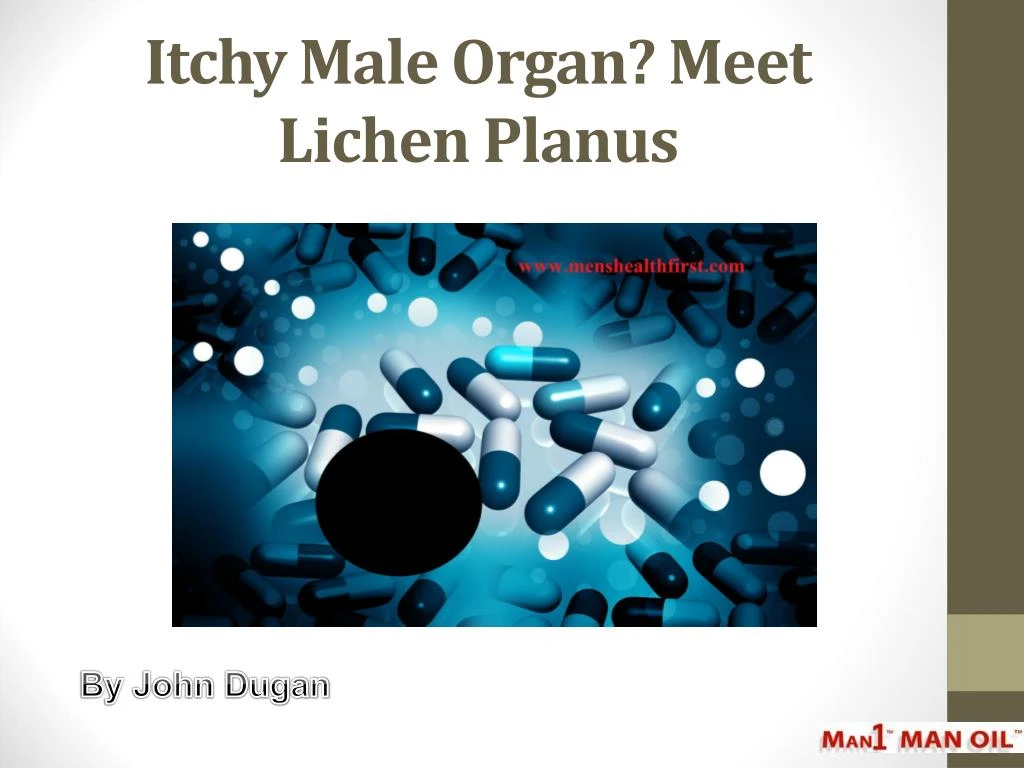 itchy male organ meet lichen planus