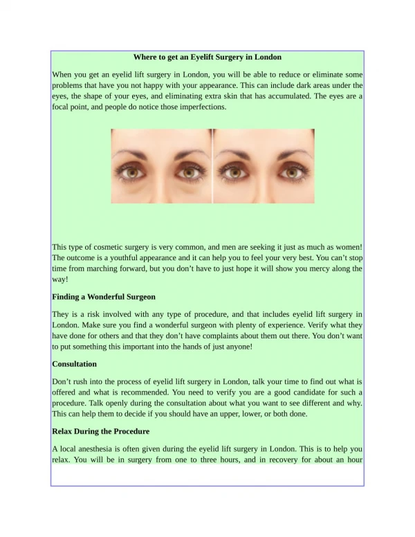 Where to get an Eyelift Surgery in London
