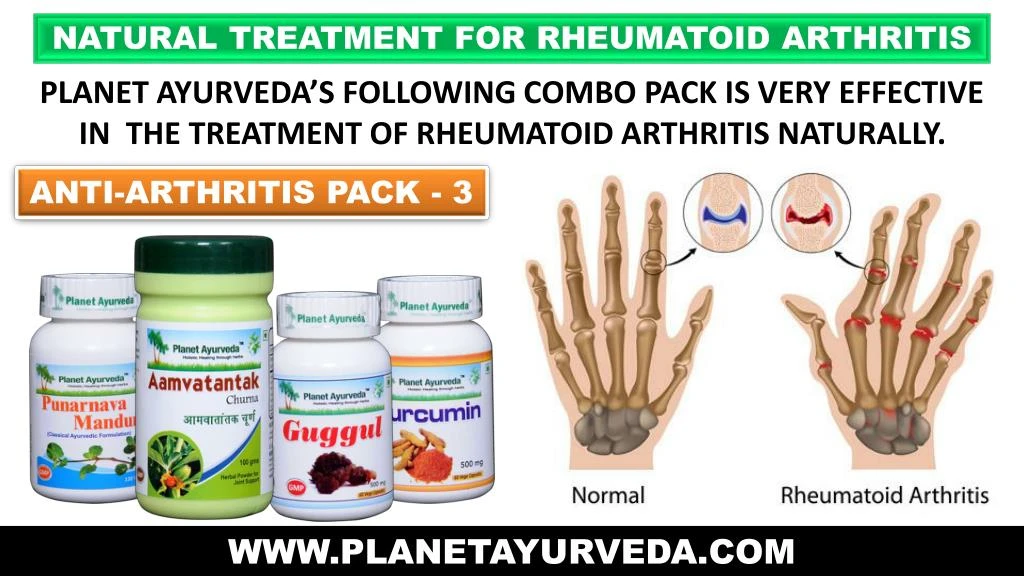 natural treatment for rheumatoid arthritis