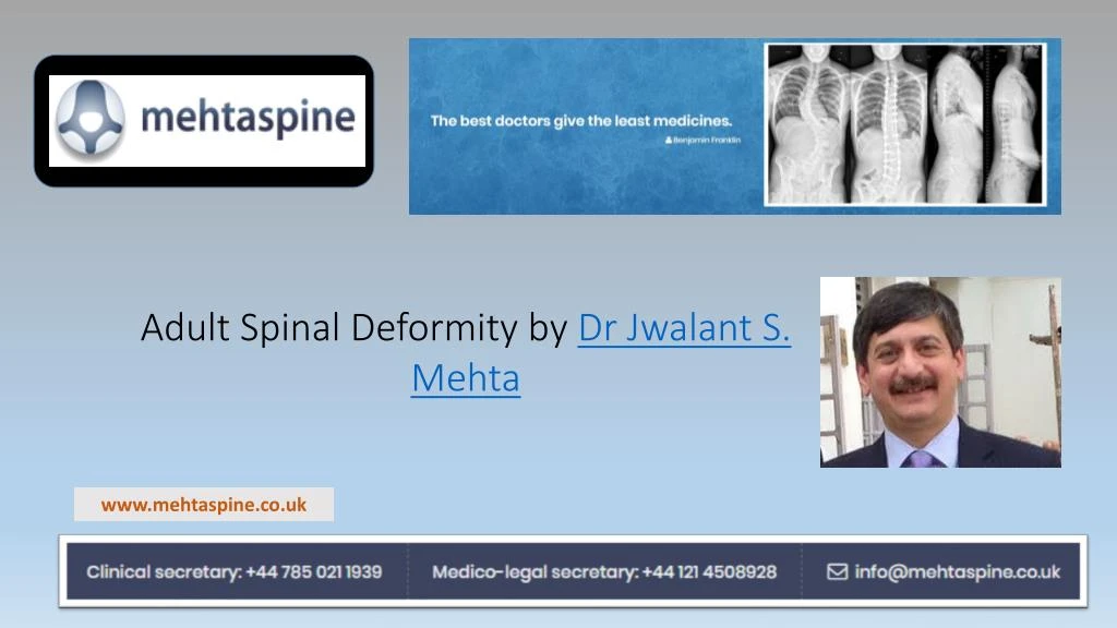 adult spinal deformity by dr jwalant s mehta