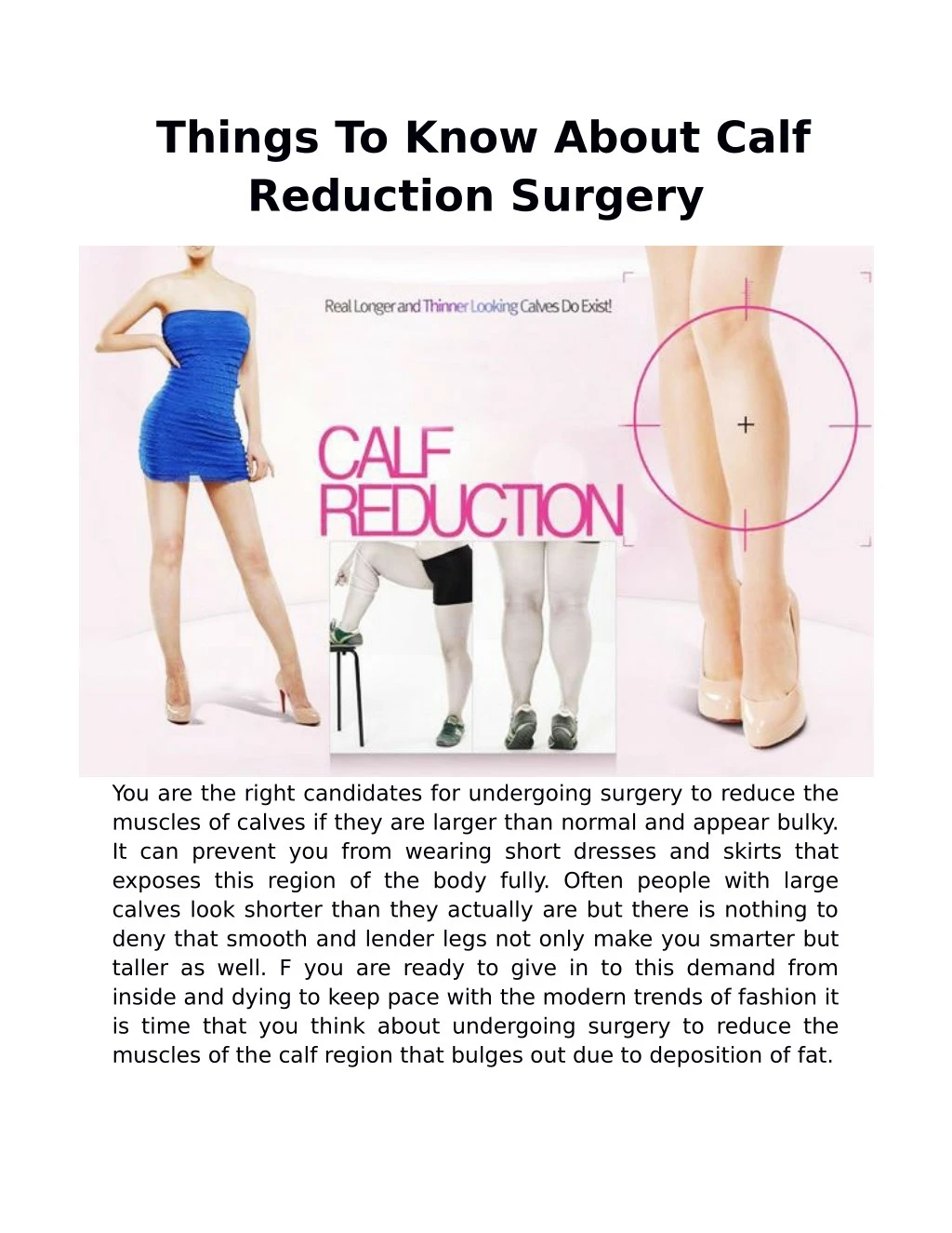 things to know about calf reduction surgery