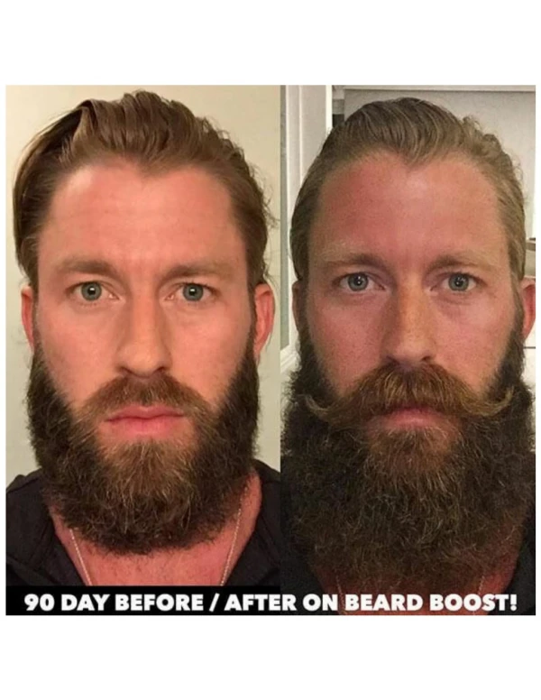 http://www.supplementdad.com/maverick-beard-growth/