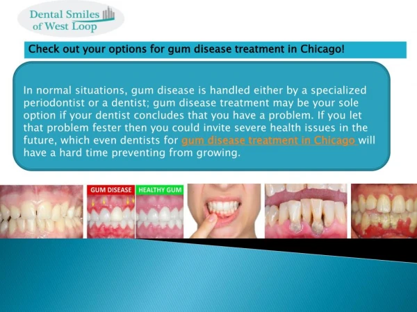 Check out your options for gum disease treatment in Chicago!