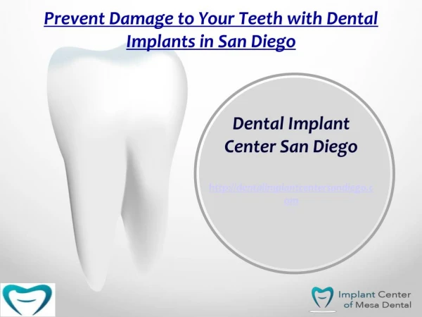 Prettify Your Pearlies with Dental Implants San Diego