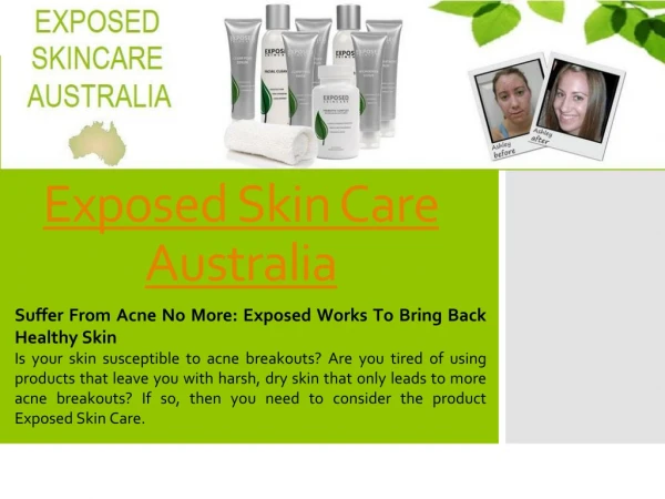 Exposed Skin Care Australia