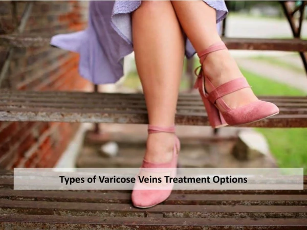 Types of Varicose Veins Treatment Options