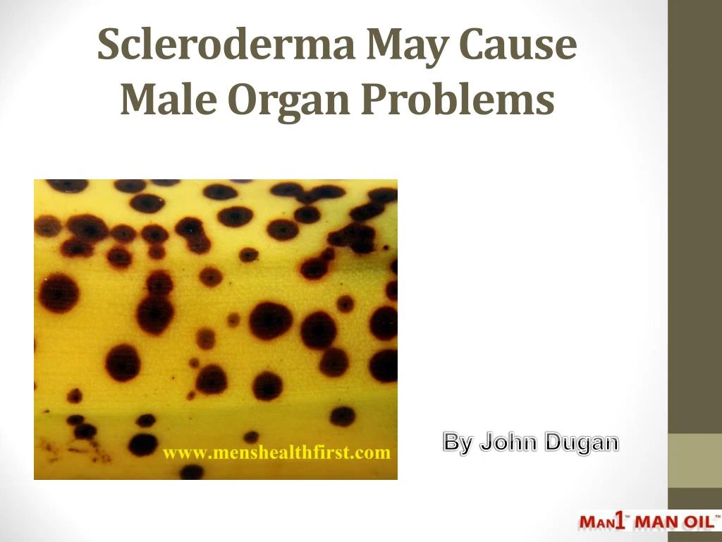 scleroderma may cause male organ problems