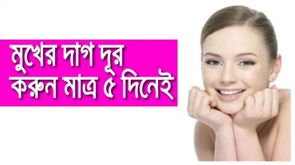 Remove the stains of the face in just 5 days ! Beauty Tips in Bangla 2018