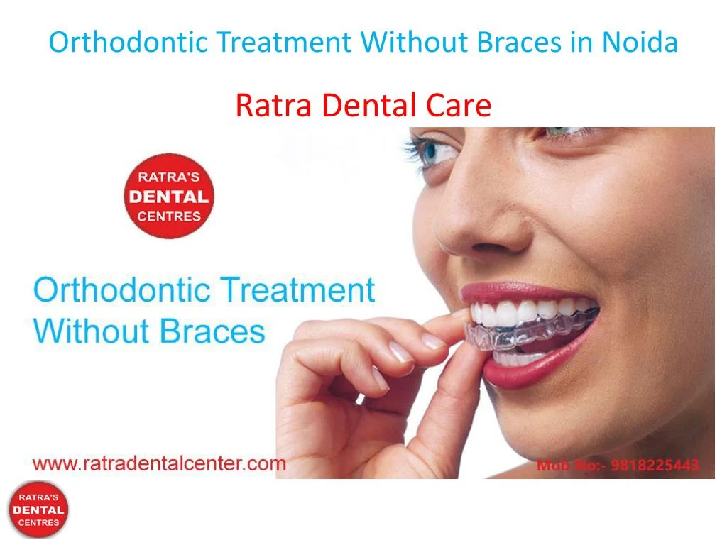 orthodontic treatment without braces in noida