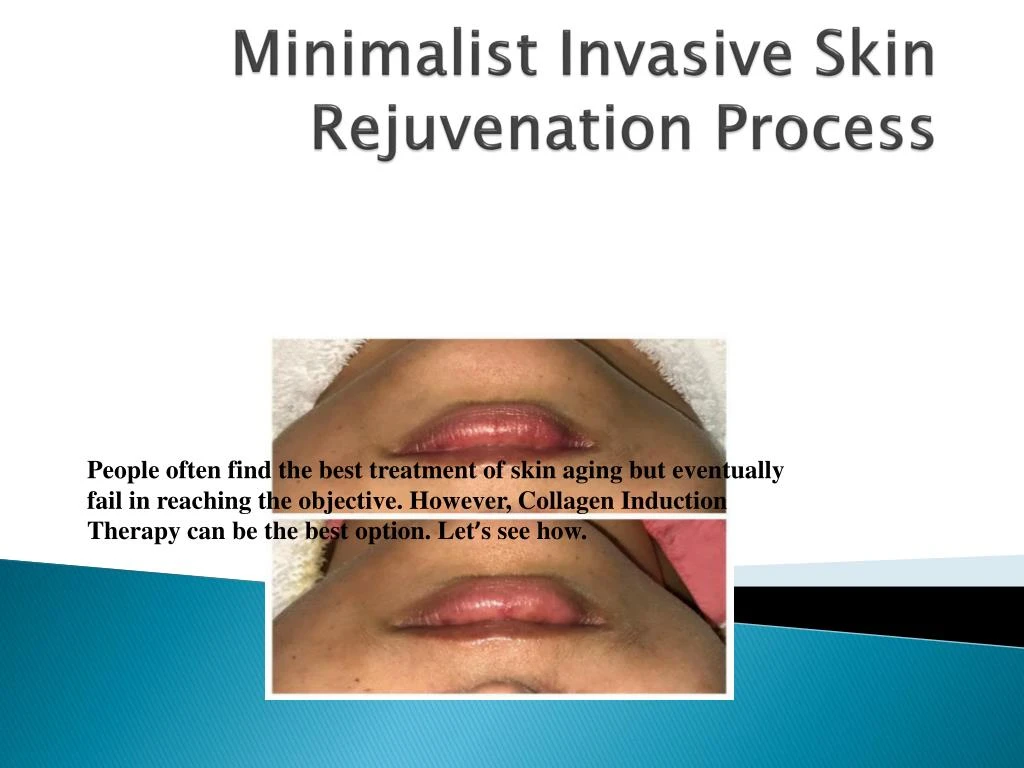 minimalist invasive skin rejuvenation process