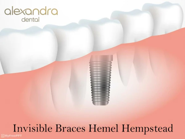 Invisible Braces Hemel Hempstead