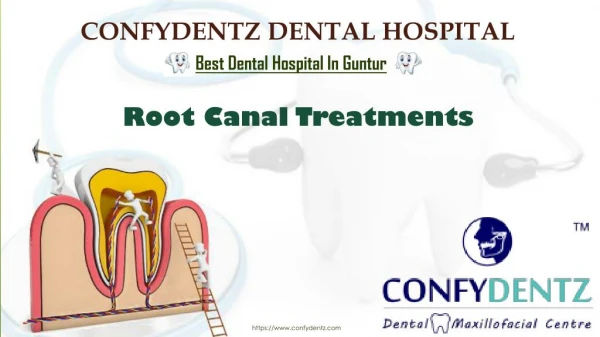 Root Canal Treatment Cost in Guntur | Root Canal Treatments In Guntur