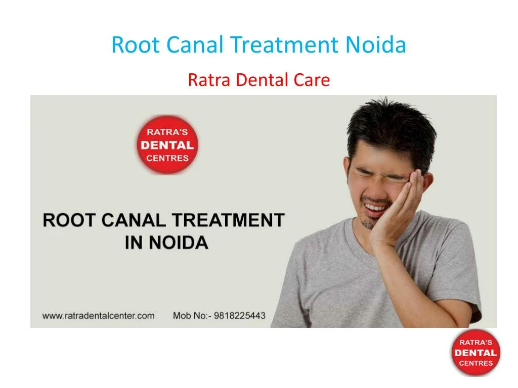 root canal treatment noida