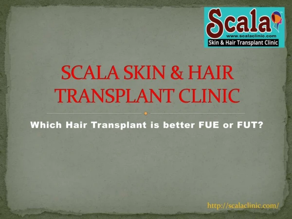 Top Hair Transplant Surgeons in Hyderabad | Non Surgical Hair Replacement Cost in Hyderabad