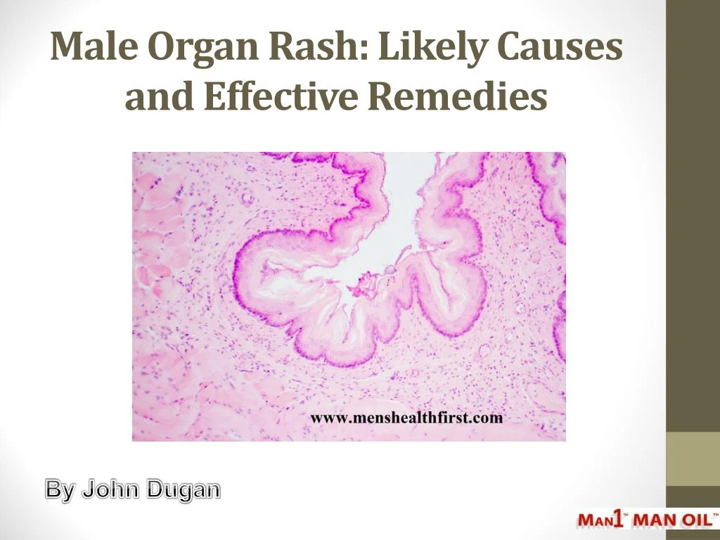 male organ rash likely causes and effective remedies