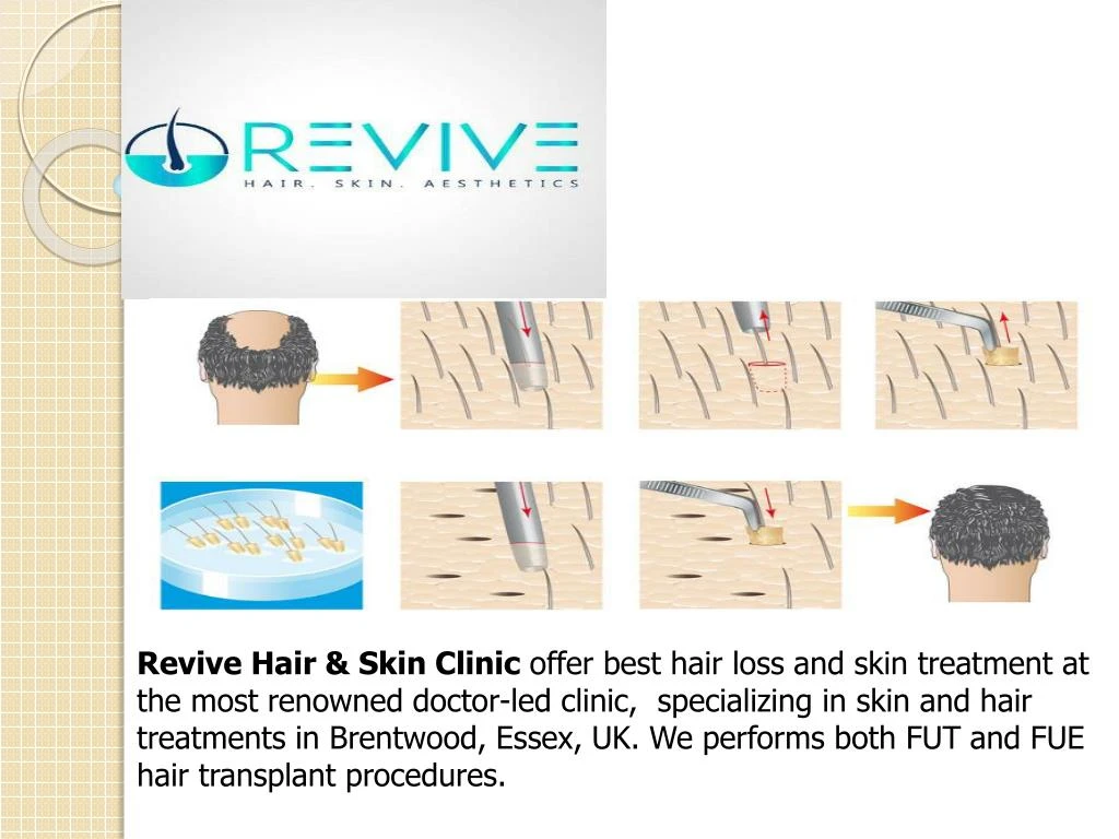 revive hair skin clinic offer best hair loss
