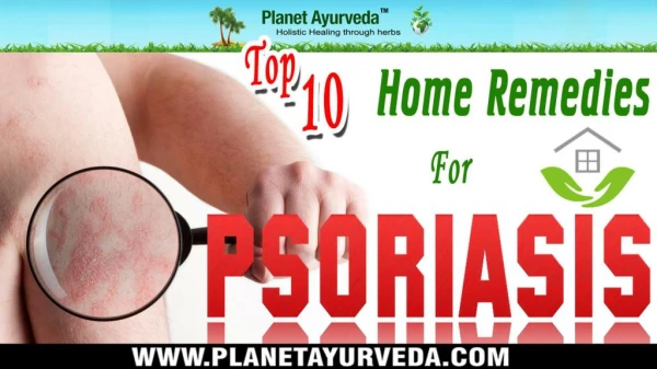 Top 10 Home Remedies for Psoriasis | Natural Treatment