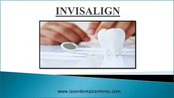 Top points to consider when finding Invisalign provider