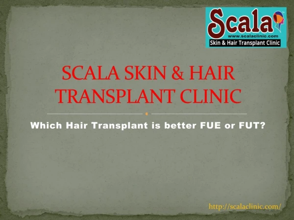 Best Hair Transplantation Clinic in Hyderabad| Top Hair Transplant Surgeons in Hyderabad