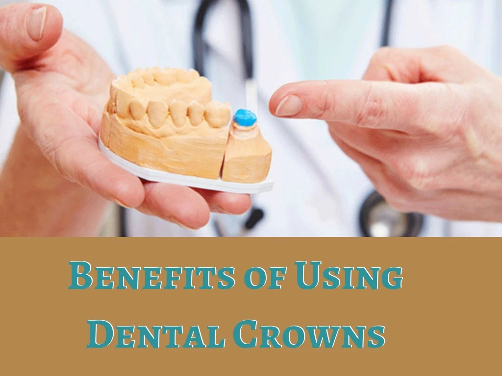 benefits of using dental crowns dental crowns