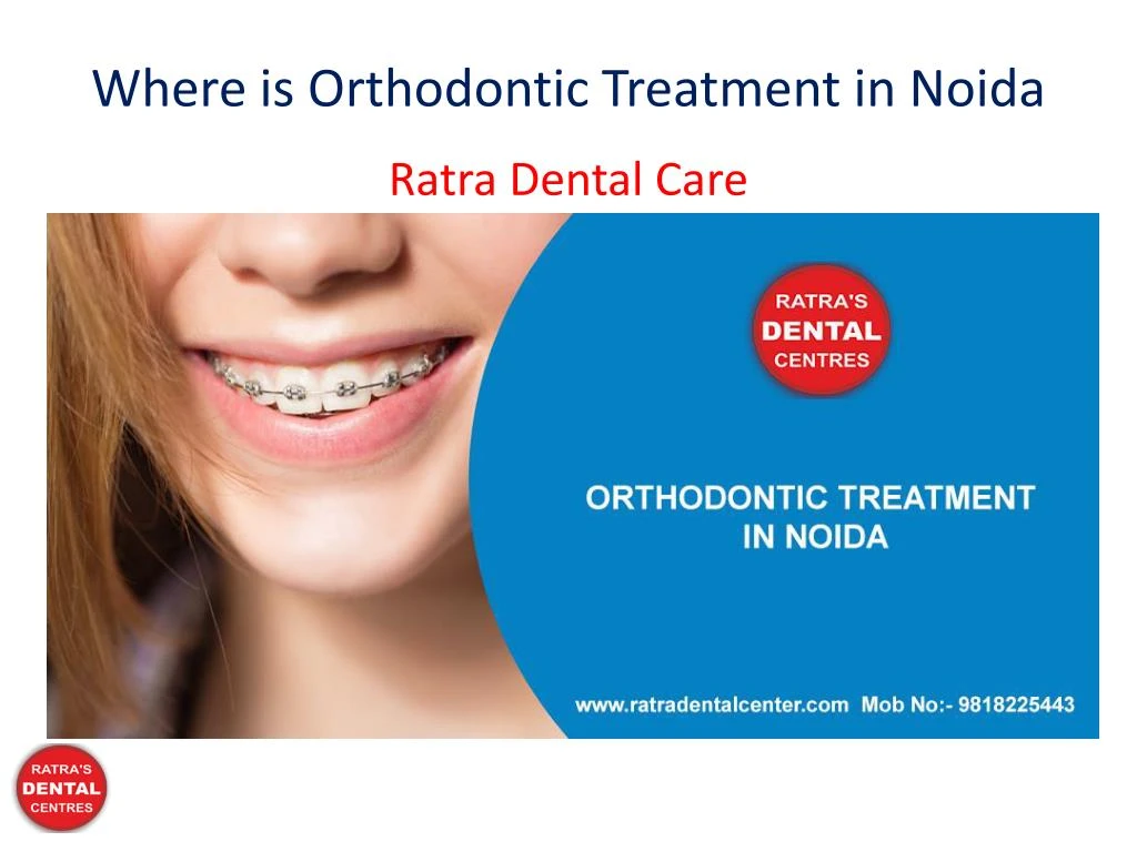 where is orthodontic treatment in noida