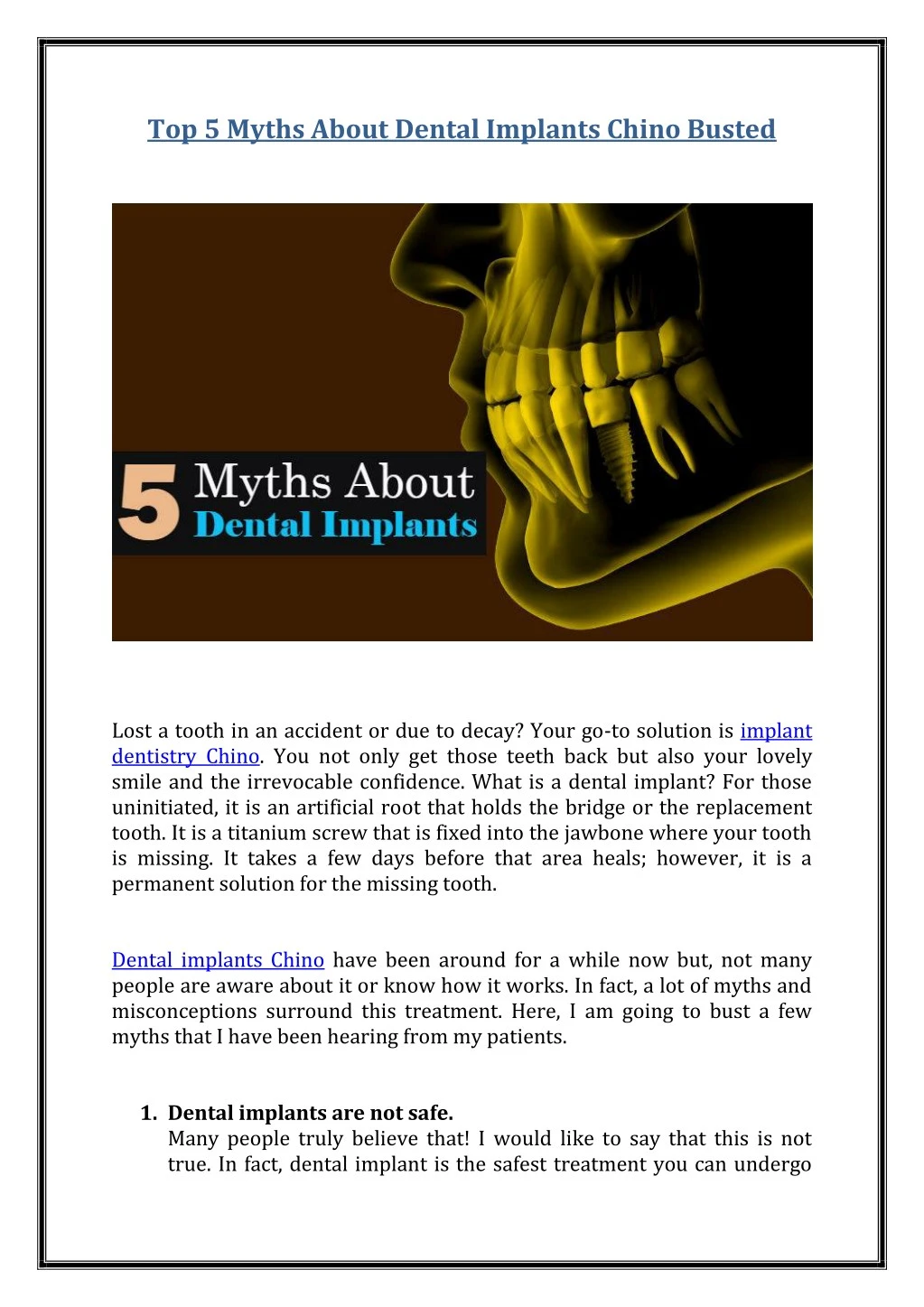 top 5 myths about dental implants chino busted