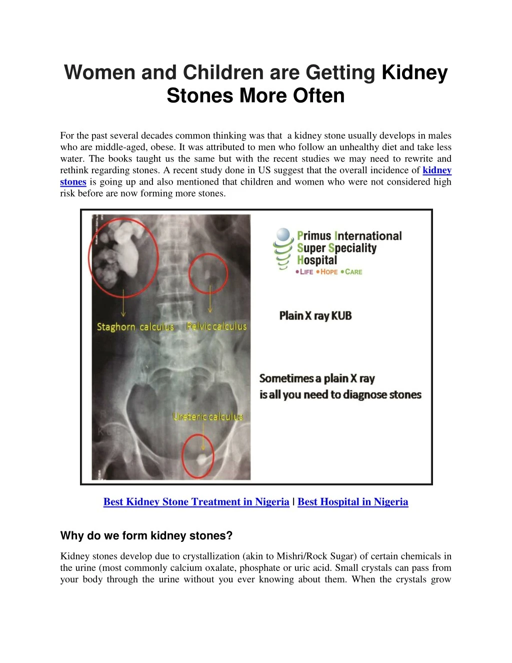 women and children are getting kidney stones more