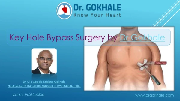 Key Hole Bypass Surgery by Dr Gokhale