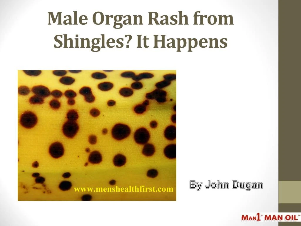 male organ rash from shingles it happens