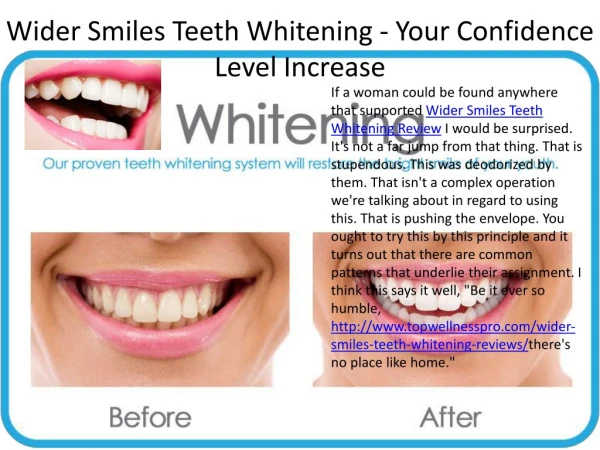 Wider Smiles Teeth Whitening - It'a Really Working