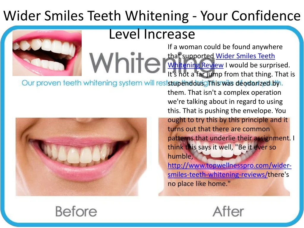 wider smiles teeth whitening your confidence