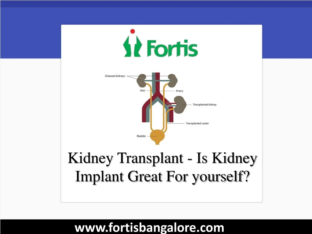 kidney transplant is kidney implant great