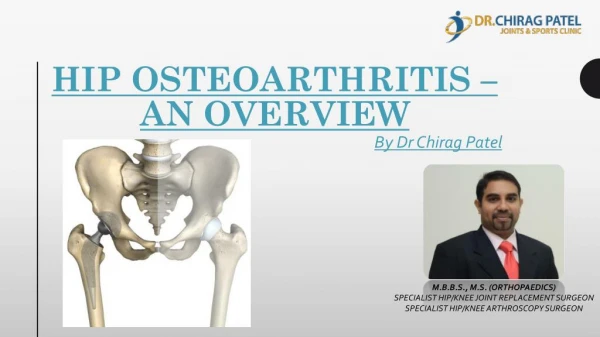 Hip Osteoarthritis - An Overview | Dr Chirag Patel