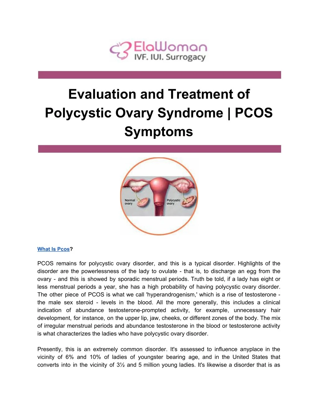 evaluation and treatment of polycystic ovary