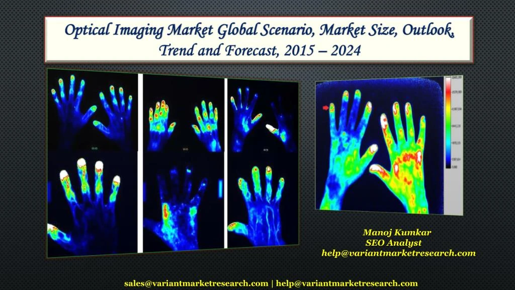 optical imaging market global scenario market