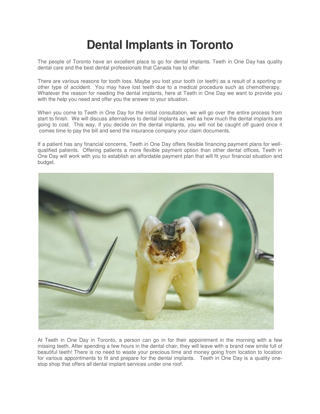 dental implants in toronto