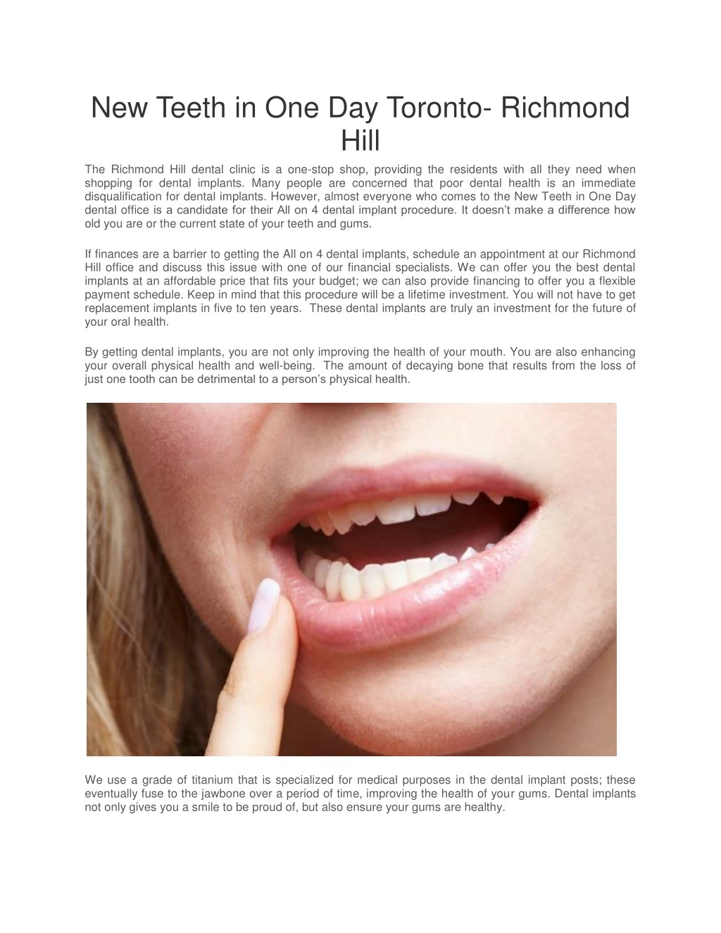 new teeth in one day toronto richmond hill
