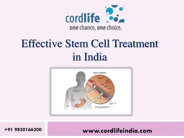 Stem Cell Treatment: Successful for Healing Parkinson's Illness