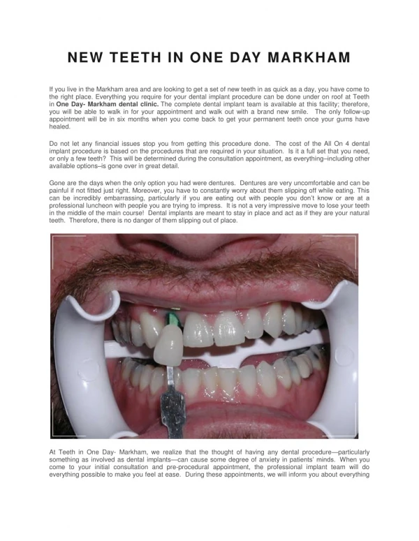 NEW TEETH IN ONE DAY MARKHAM