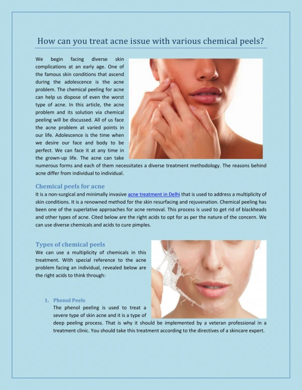 How can you treat acne issue with various chemical peels?